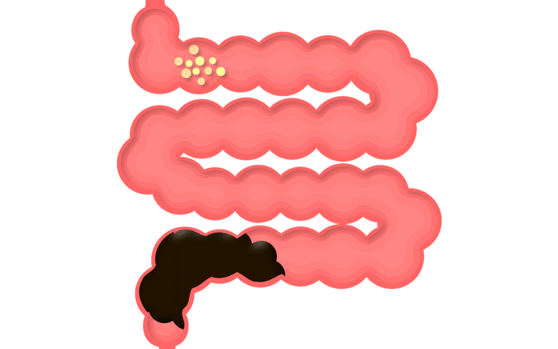 비만세균 관련 이미지