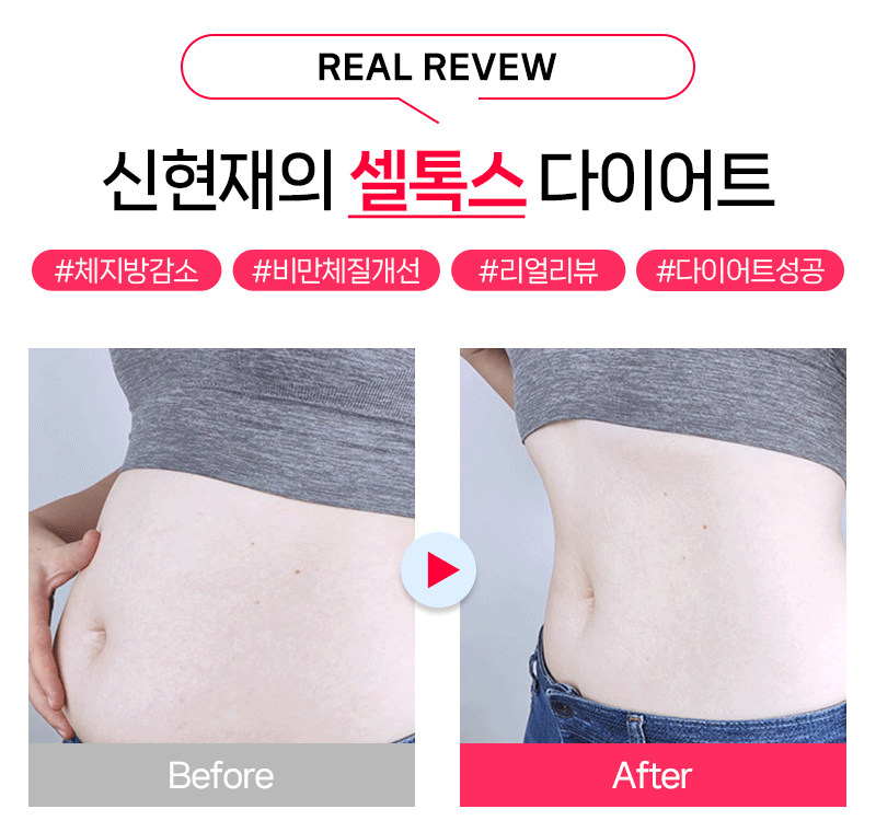 리얼 리뷰 전후 비교 이미지